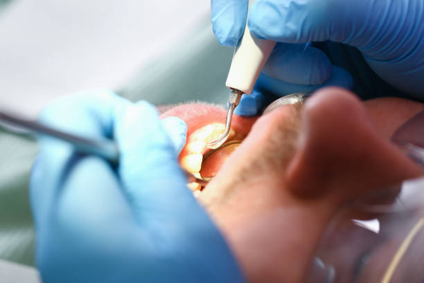 Best Emergency Dental Care for Sports Injuries in Ttapoisett Center, MA